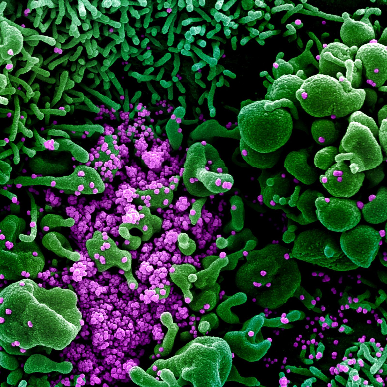 Electron micrographic images of SARS-CoV-2 – Bifrost